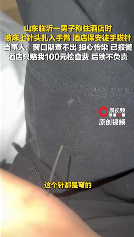 山东临沂，一名男子入住酒店，洗完澡准备休息时，手臂被床上的针头扎伤，酒店派了一名