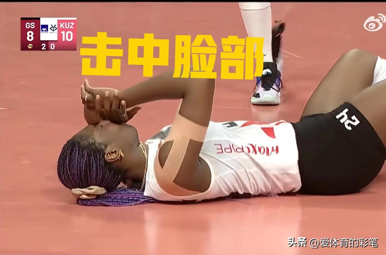 这一幕把王媛媛吓得捂着脸[捂脸]，土耳其杯1/4决赛，与库泽博鲁的第三局10:8