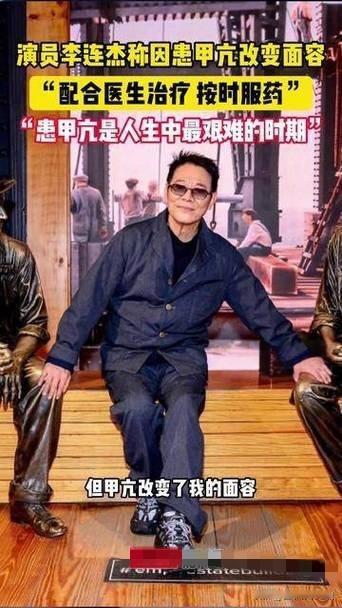 李连杰：甲亢下的坚韧人生
近日，李连杰直面回应甲亢病情，令人动容。他透露，甲亢让