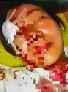 。外卖小哥的“差评逆袭”：当晚餐变成了拳击赛！

在这个快节奏的生活中，外卖已经