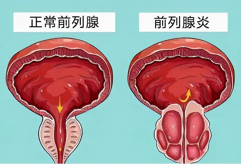 【患者提问】我想请问下，为什么我男友的精液是黄的？我和男友交往有几周了，就在昨天