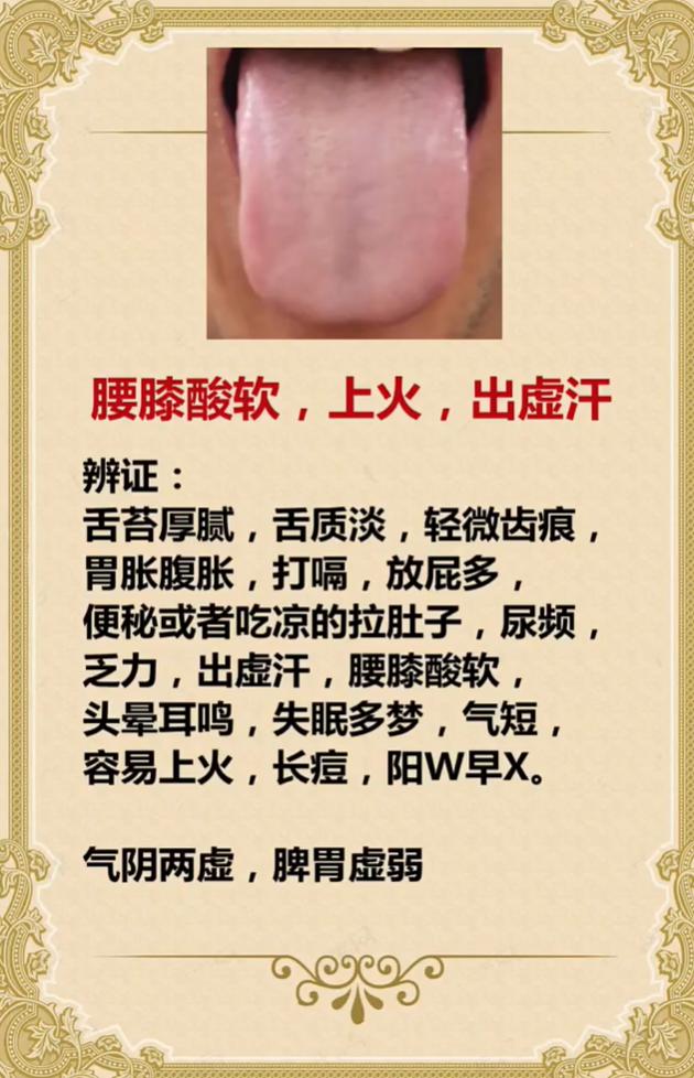 腰膝酸软、易上火出虚汗？多半是气阴两虚、脾胃虚弱
