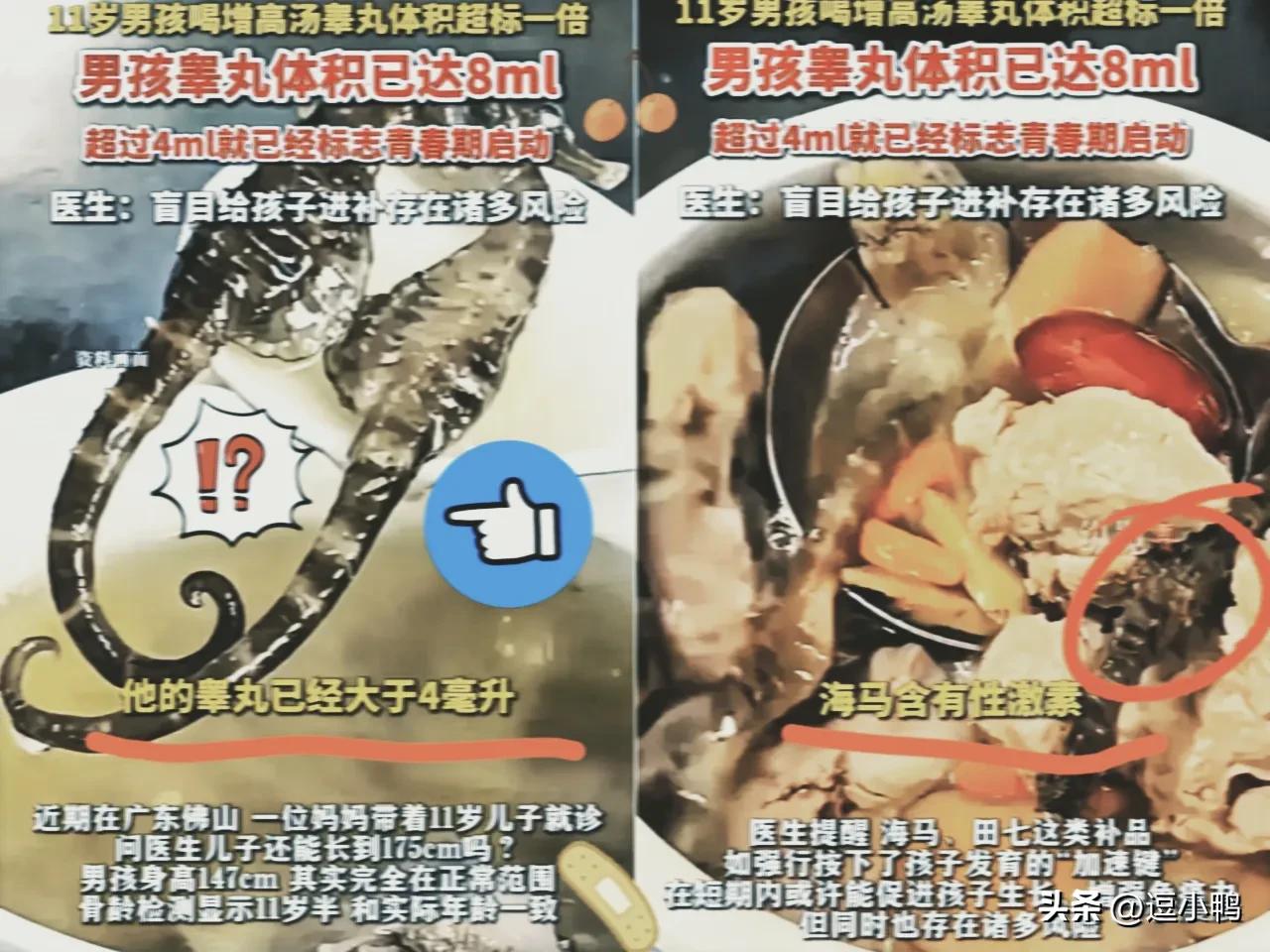 担心的事情还是发生了！
 
广东佛山一位妈妈怕11岁儿子

长不到175，天天熬