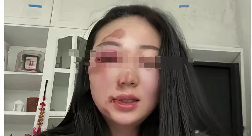 女婿昨天把女儿打了，我气的问啥原因，为什么敢打我的宝贝女儿，女婿说，女儿每天下班