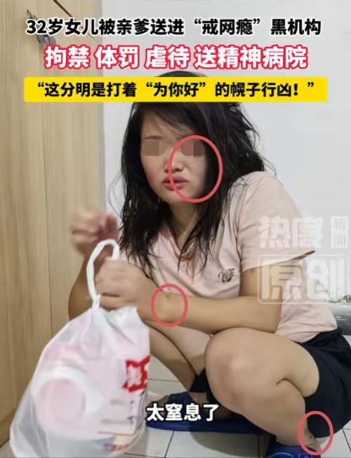 "都是为了你好！"

太荒唐了！6 月 5 日报道，湖北一位父亲竟强行把 32 