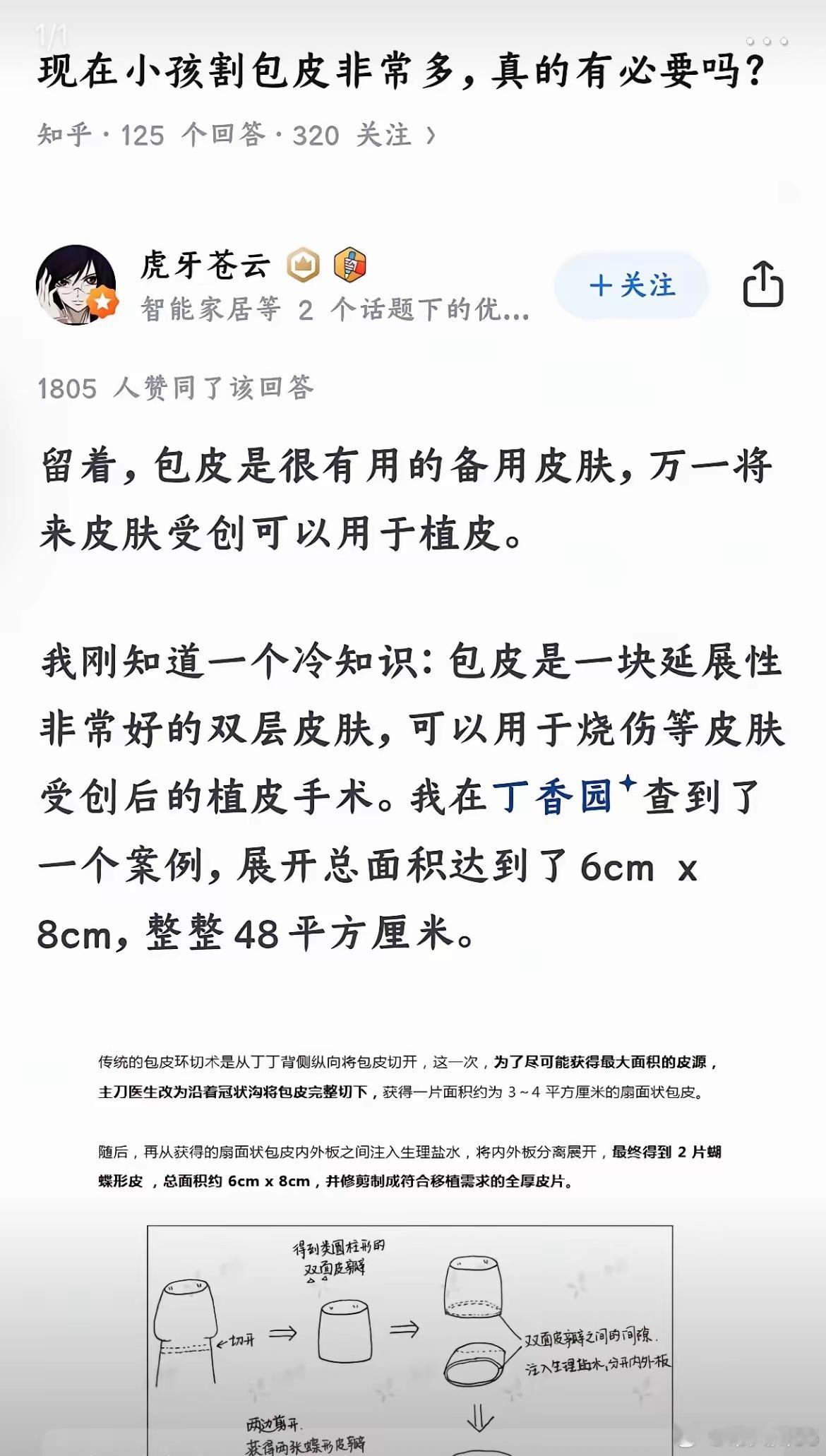 畸形的是极极少数，正常人都不用割。长大了自然褪下去，这就是医院为了创收而制造的焦