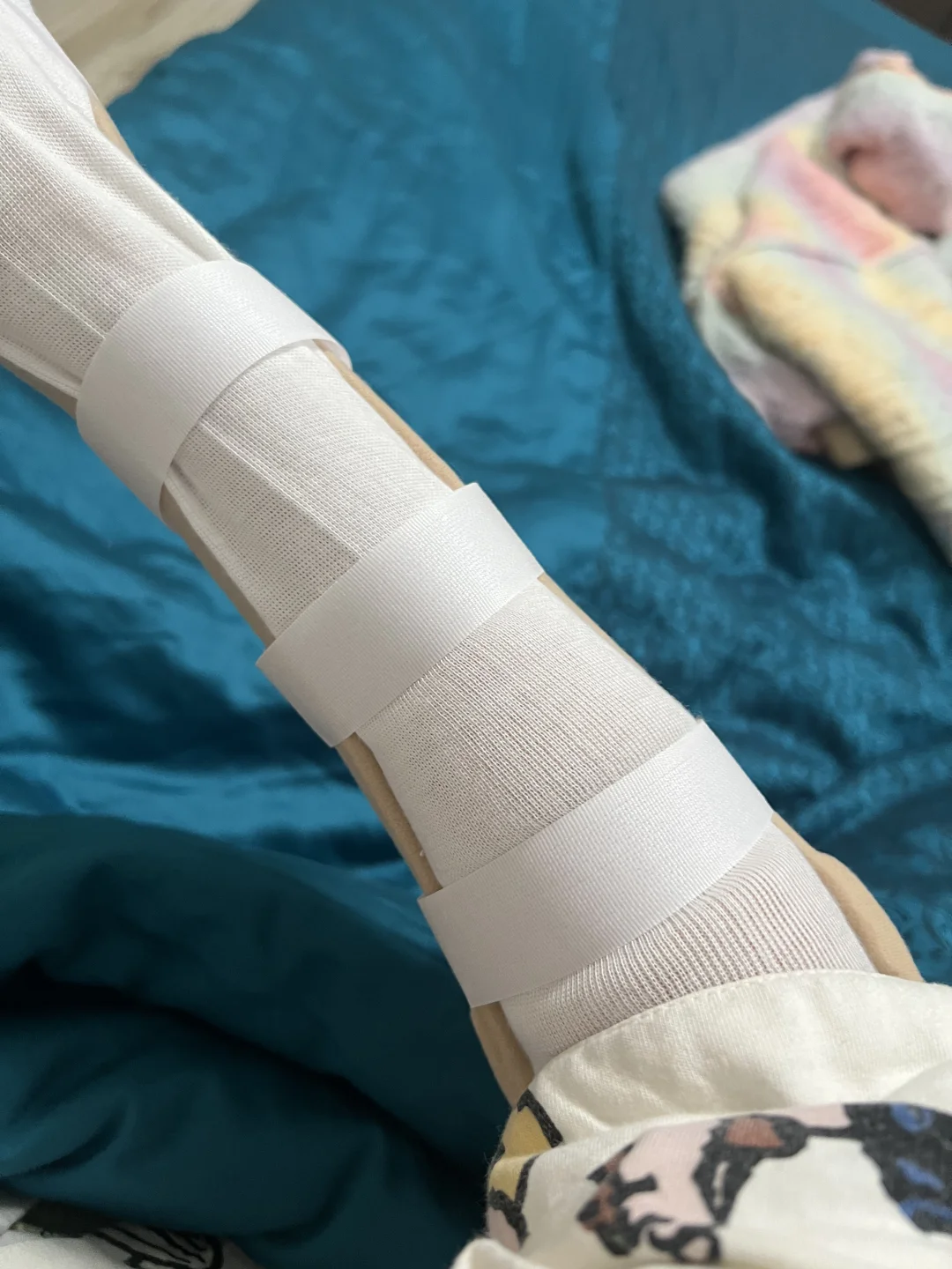 我emo了！！骨折最痛苦的是什么？