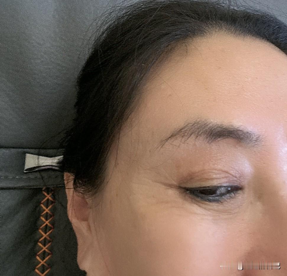 最近老的特别快，也不知道啥原因，都说拉皮手术后，会加速衰老，但是我单位几位大姐，