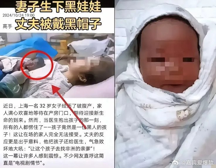 上海产妇生下黑娃事件落幕了可是万万没想到的是竟然存在两个故事版本，真假难辨！版本