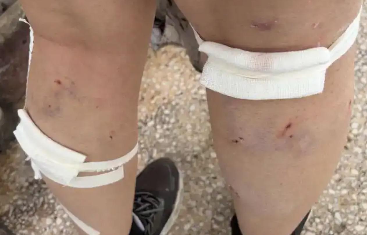 之前保安清理流浪狗遭网暴，现在回旋镖来了！
4月19日晚在平顶山学院，大三女生高