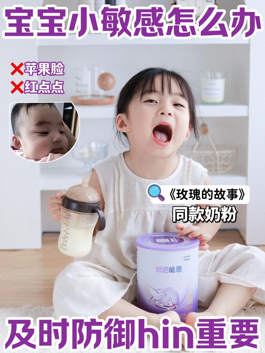 宝宝小敏感怎么办？及时防御hin重要
