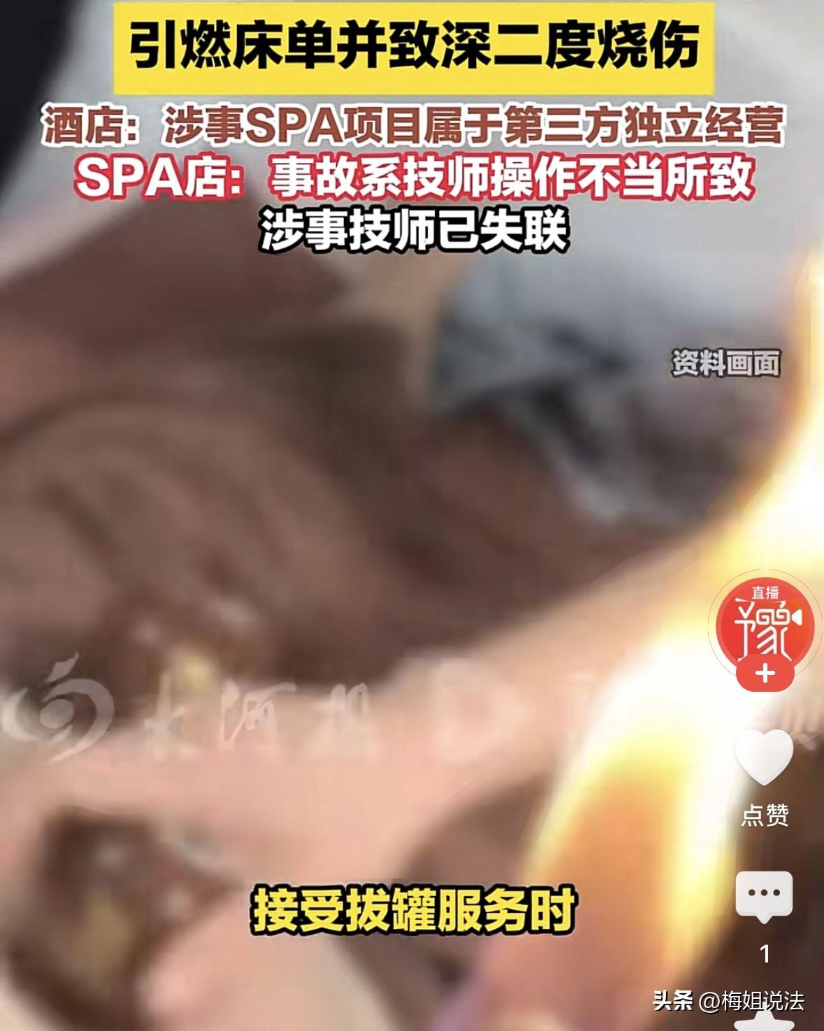 湖北武汉，女子在酒店叫了个拔火罐服务，想要放松放松，结果火苗溅到床单上引发火灾，