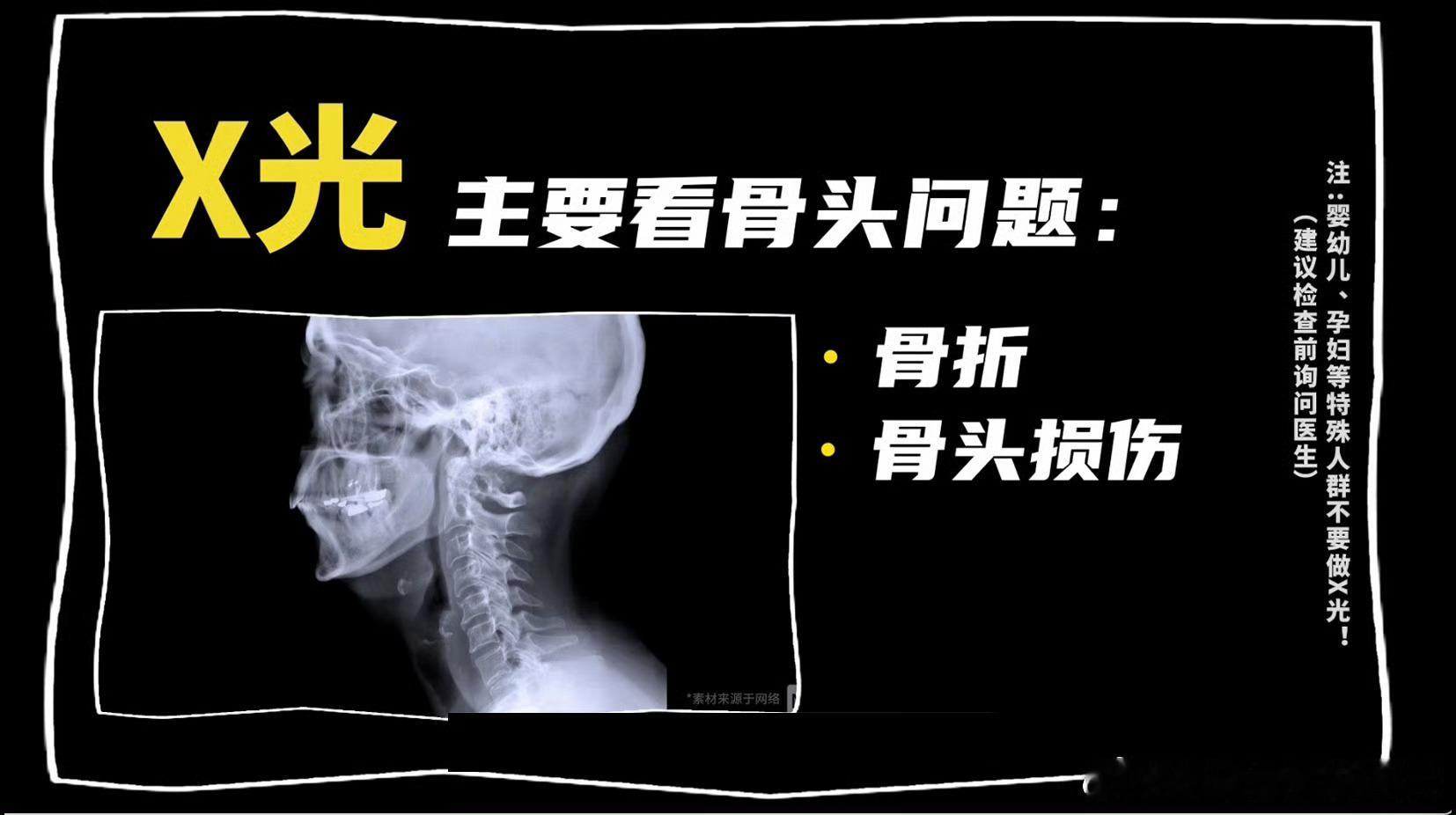 全国医院放射检查费大降价 X光、CT、核磁，普通人很难分清这些统称的“片子”到底