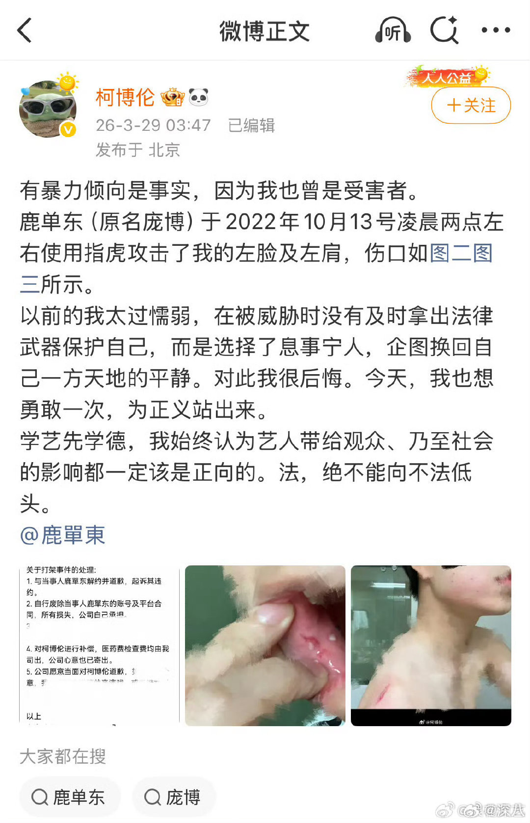 柯博伦指控鹿单东有暴力倾向柯博伦称鹿单东有暴力倾向是事实 柯博伦称鹿单东有暴力倾