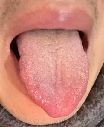 总是口干口渴，喝水也不解渴？不是缺水，是身体“缺津液”！

 很多人都有过这种困