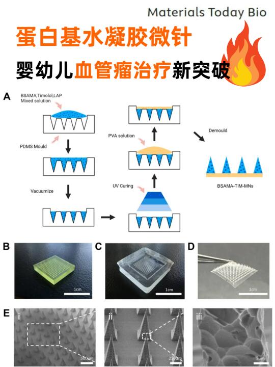 蛋白基水凝胶微针，可应用于婴幼儿IH💉