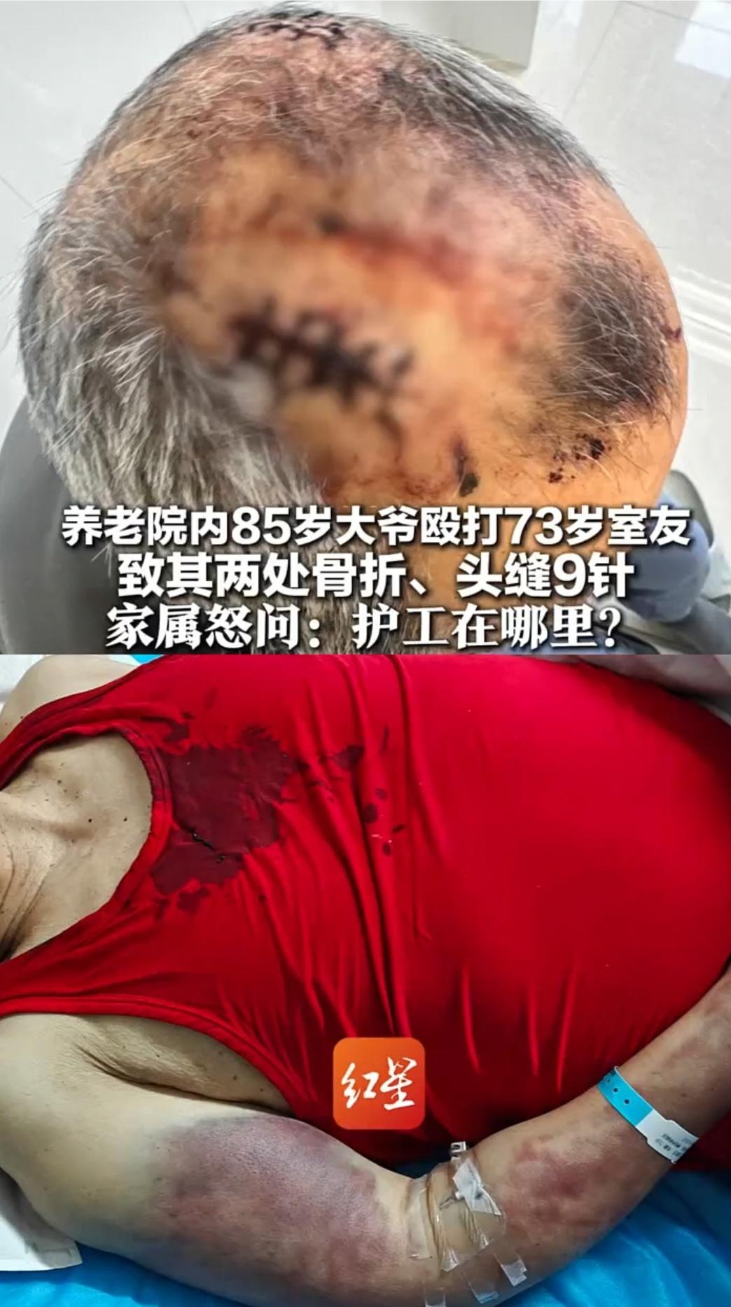 简直令人发指！内蒙古赤峰，一位73岁老人，在收费不菲的养老院里，被同住的85岁老