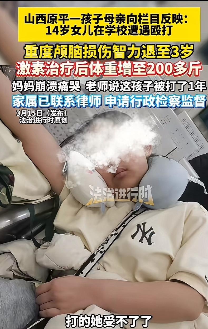 山西原平，女子给女儿洗澡时，发现女儿身上青一块紫一块，因问女儿怎么回事儿，见女儿