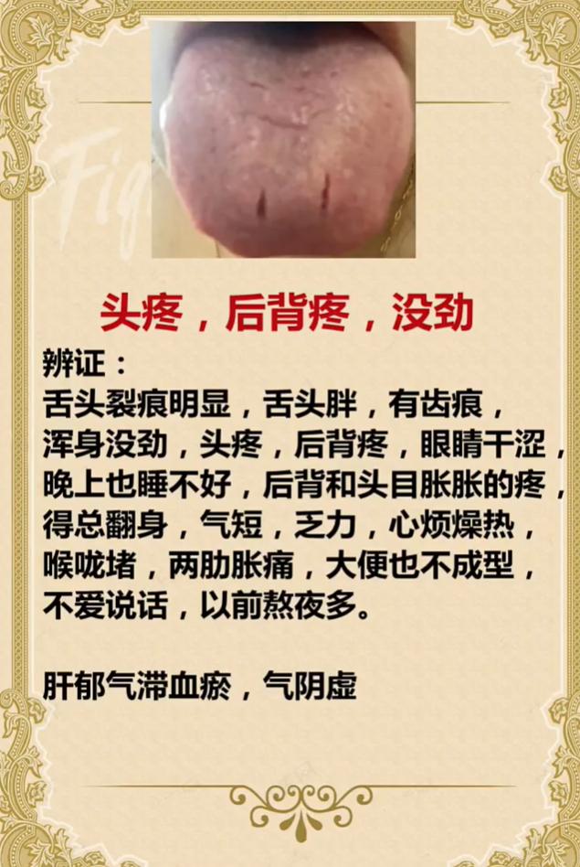 头疼背疼浑身没劲？多半是肝郁气滞血瘀、气阴两虚了