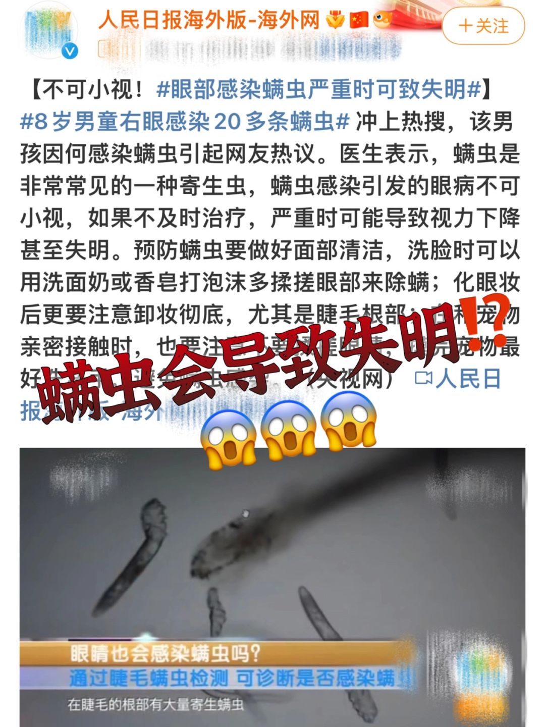 什么❗️螨虫竟然能导致失明⁉️