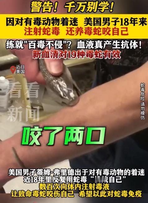 太狠了，美国一男子在家中专门饲养毒蛇，可他并不是为了卖钱，而是为了被咬，18年来