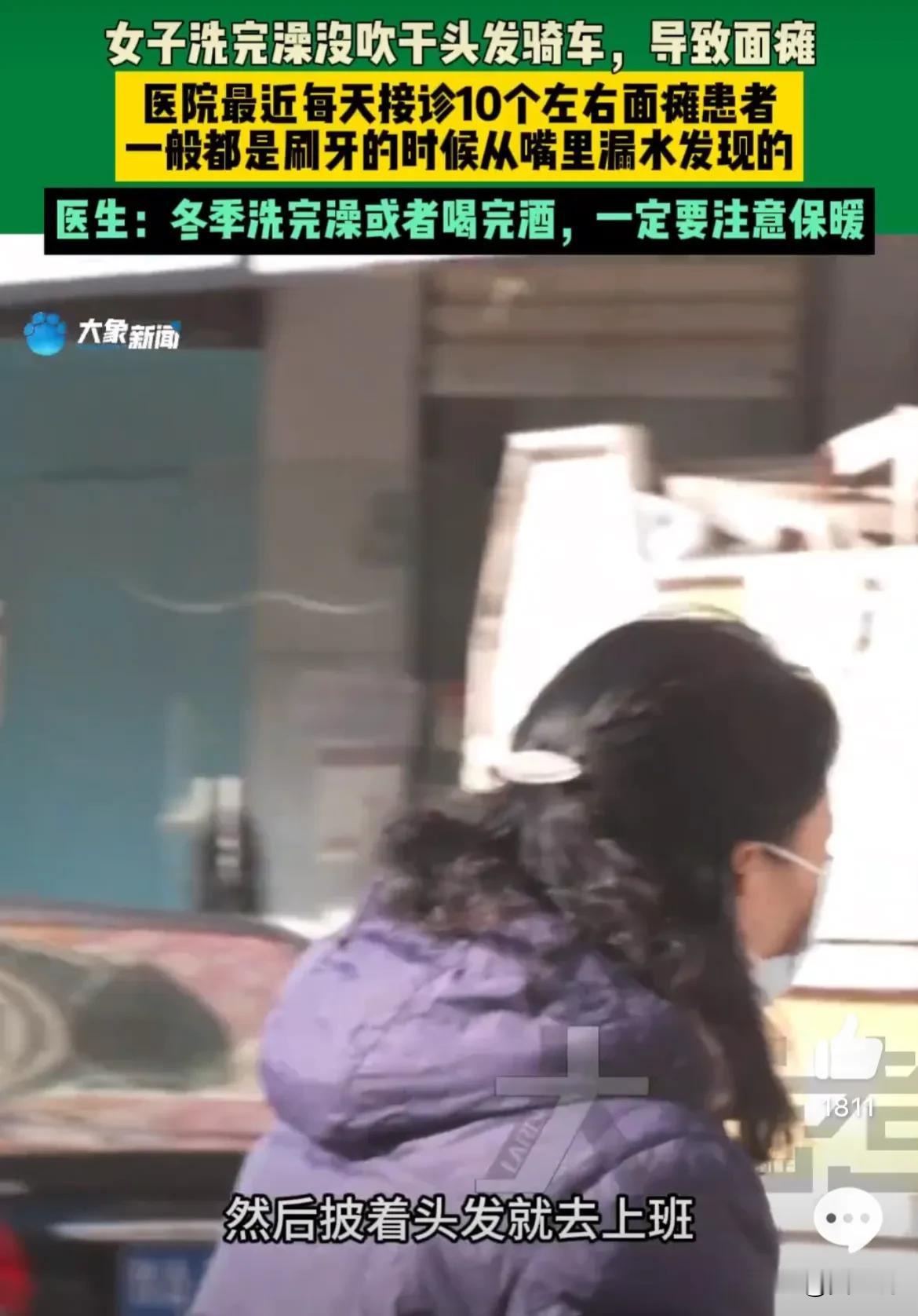 真不敢相信！洗个头还能面瘫。


河南郑州，今年33岁的杨女士，2月23日着急上