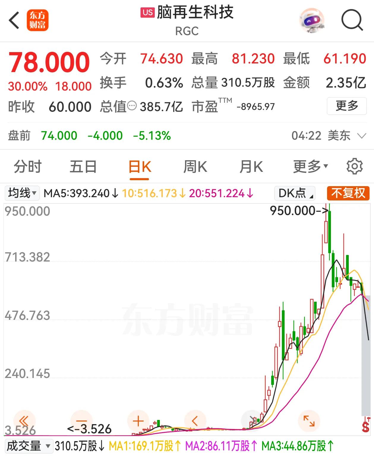 脑再生科技，今年涨幅460倍，市值到了385亿美元。这家公司年初股价才0.13元