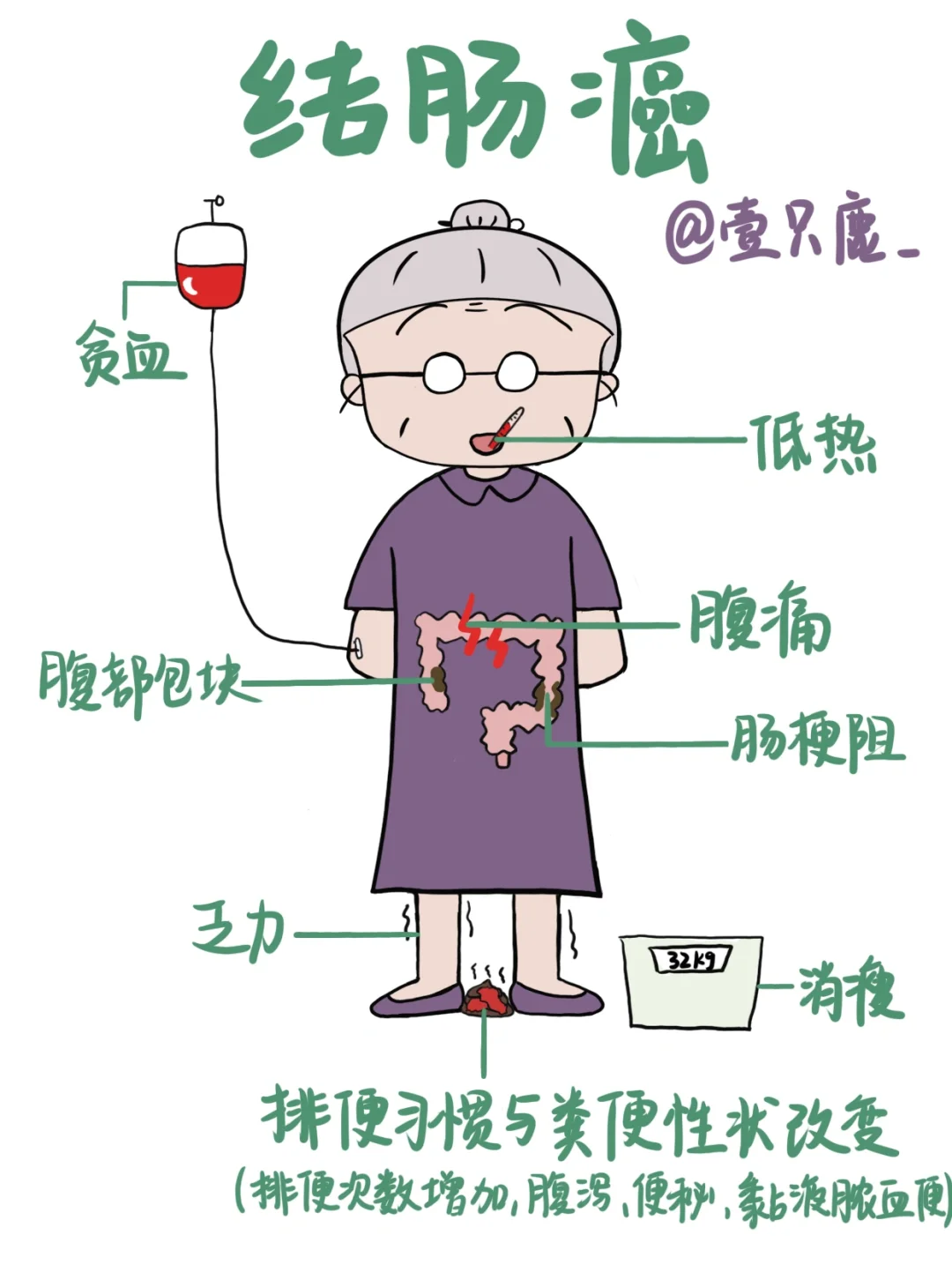 医学生笔记📒｜结肠癌🧐
