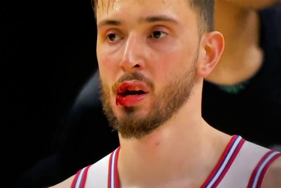 画面有不适感。
但火箭还是输了球。
申京死亡封盖，嘴都磕破了。
火箭加时。稀里糊