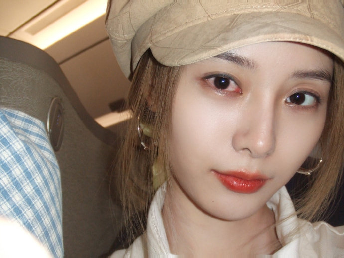 徐艺洋的眼睛怎么了 12月2日，晒11月plog，有网友发现其中有几张照片看起来