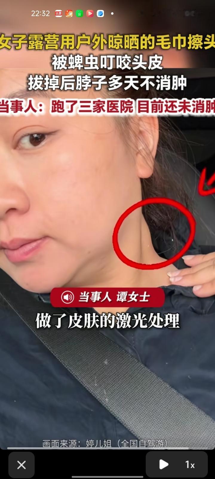 6月10日，贵州贵阳。女子发视频称，自己露营时洗了个头发，用了在户外晾晒的毛巾擦