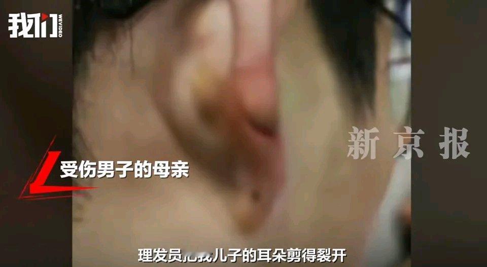 广东江门这事儿太离谱了！12月17日，一男子在新会区一家理发店剪发，耳朵竟被理发