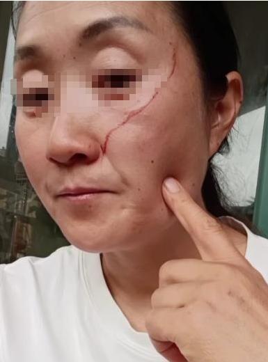 株洲高考母女的母亲，很愚蠢，也不值得同情。


一场高考后的懒觉，怎么就砸出一地