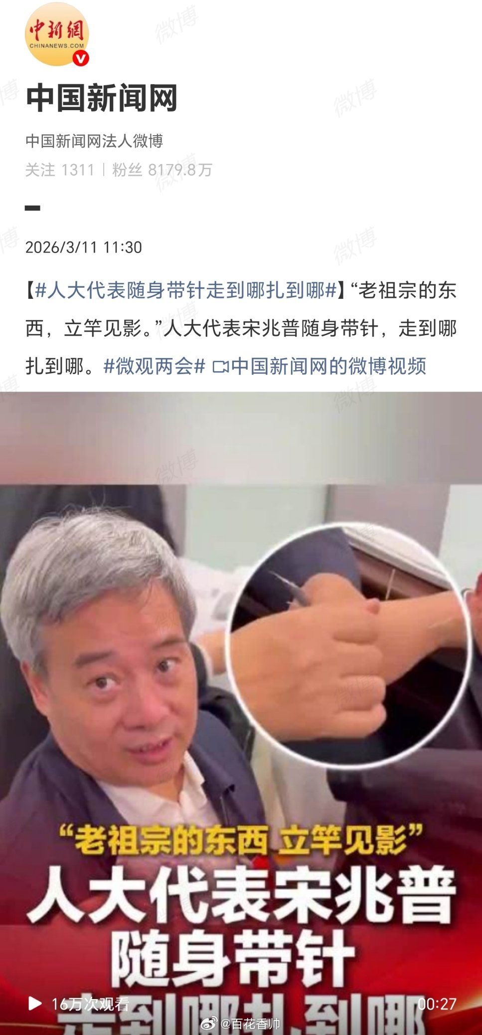 人大代表随身带针走到哪扎到哪这不仅是医者仁心的生动写照，更以立竿见影的疗效让古老
