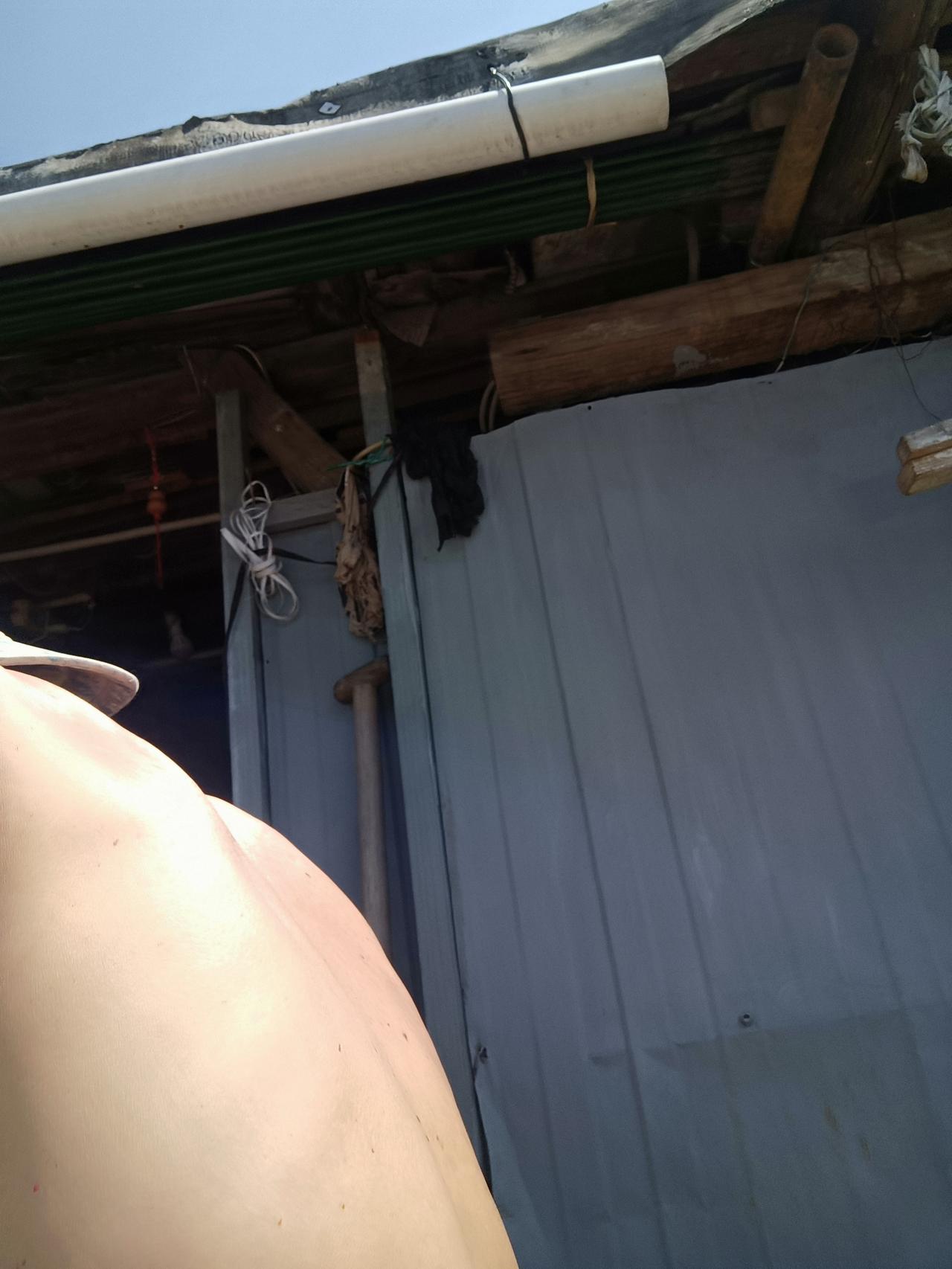 后背疼痛折磨半月 治疗对路效果立竿见影一一
四月中下旬，我后背(腰部以上)可能是
