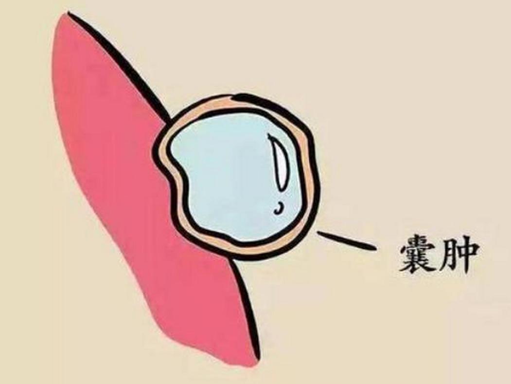 体内有肿瘤的人，身体一般会有7个表现，一定要引起注意
1、经常感觉疲劳，浑身乏力