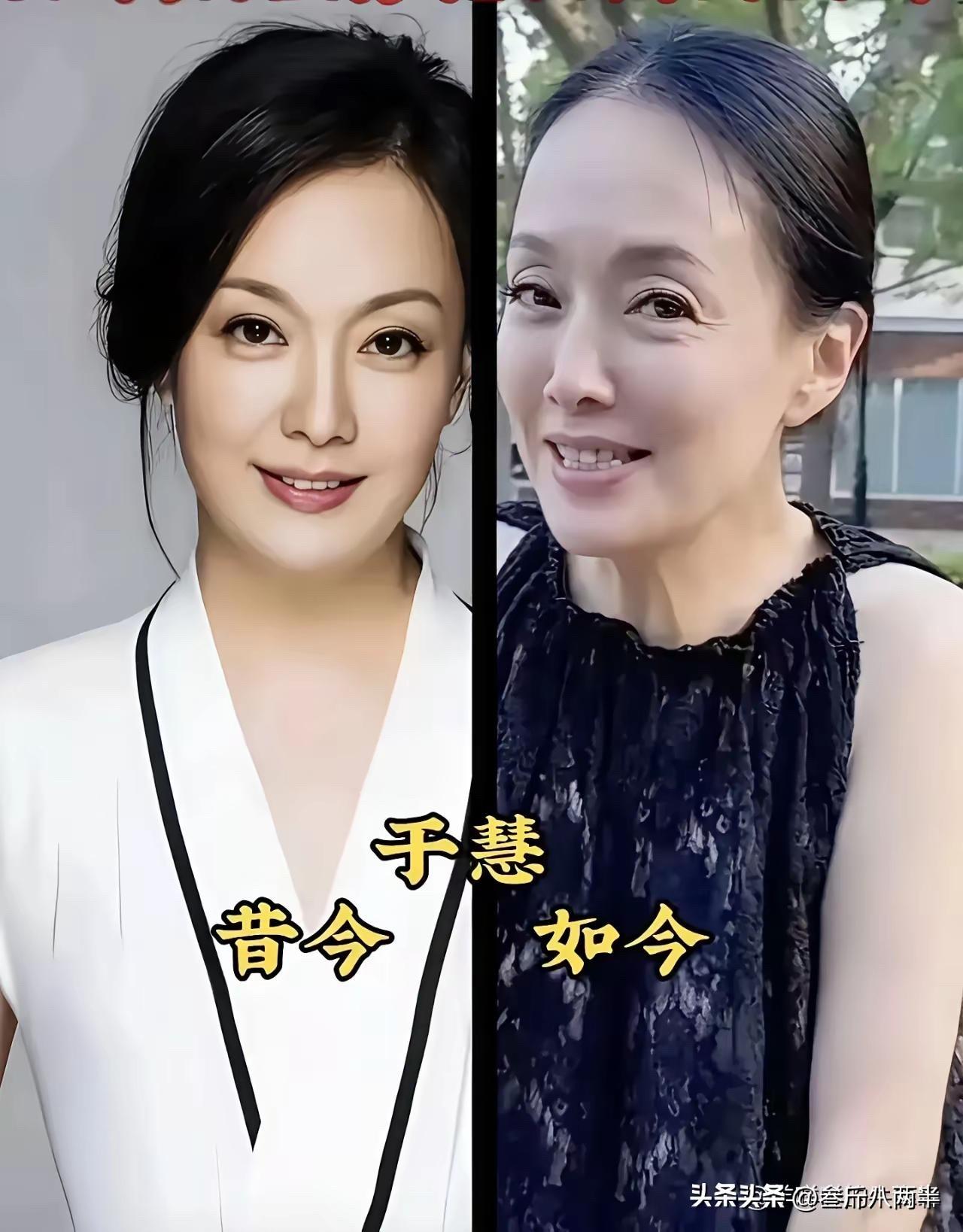 6位“剧抛脸”女演员今昔对比，年轻时个个是女神，如今越老越优雅

先说于慧——温