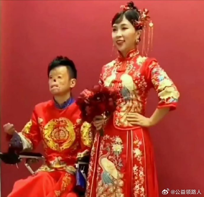 90后消防员在大火中救出女孩，他不幸重度烧伤，女孩不顾家人反对毅然嫁给了小伙。女