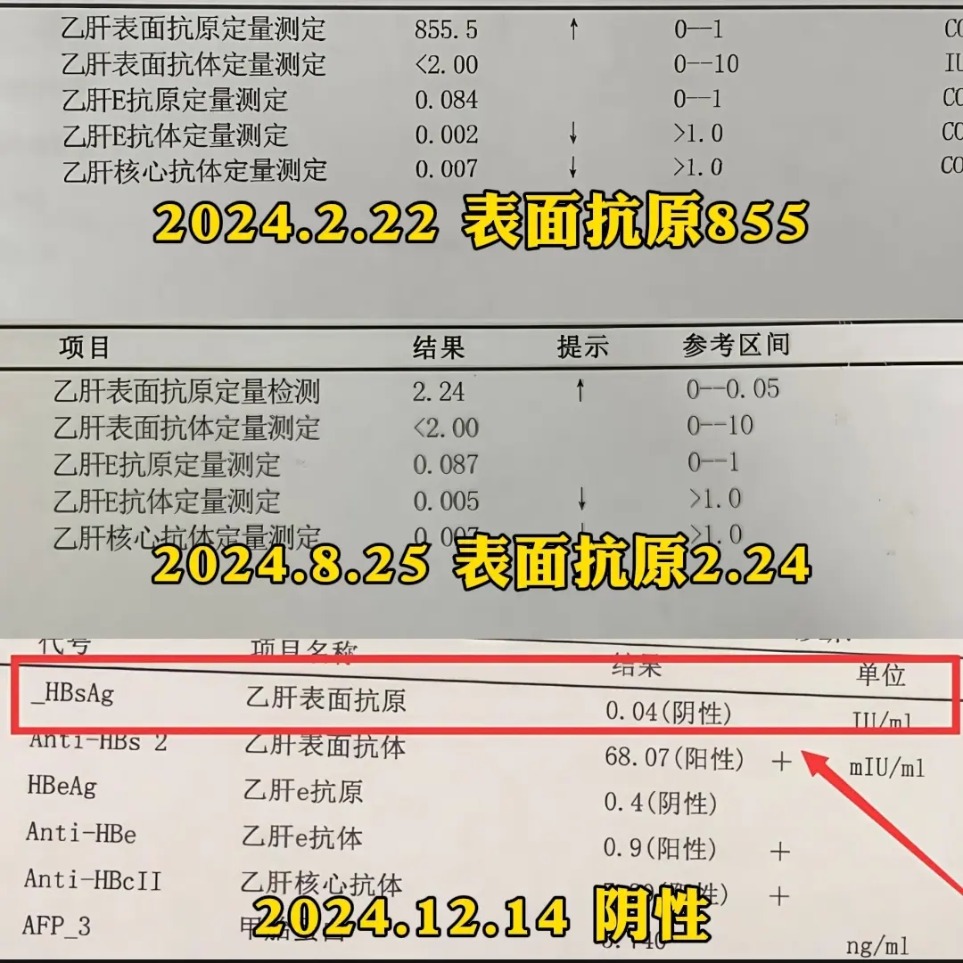 大家看这位患者的乙肝五项检查单，山东枣庄的一位兄弟，37岁，乙肝十几年...