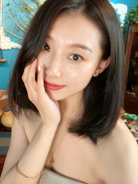 石家庄双眼皮6.8mm三年后