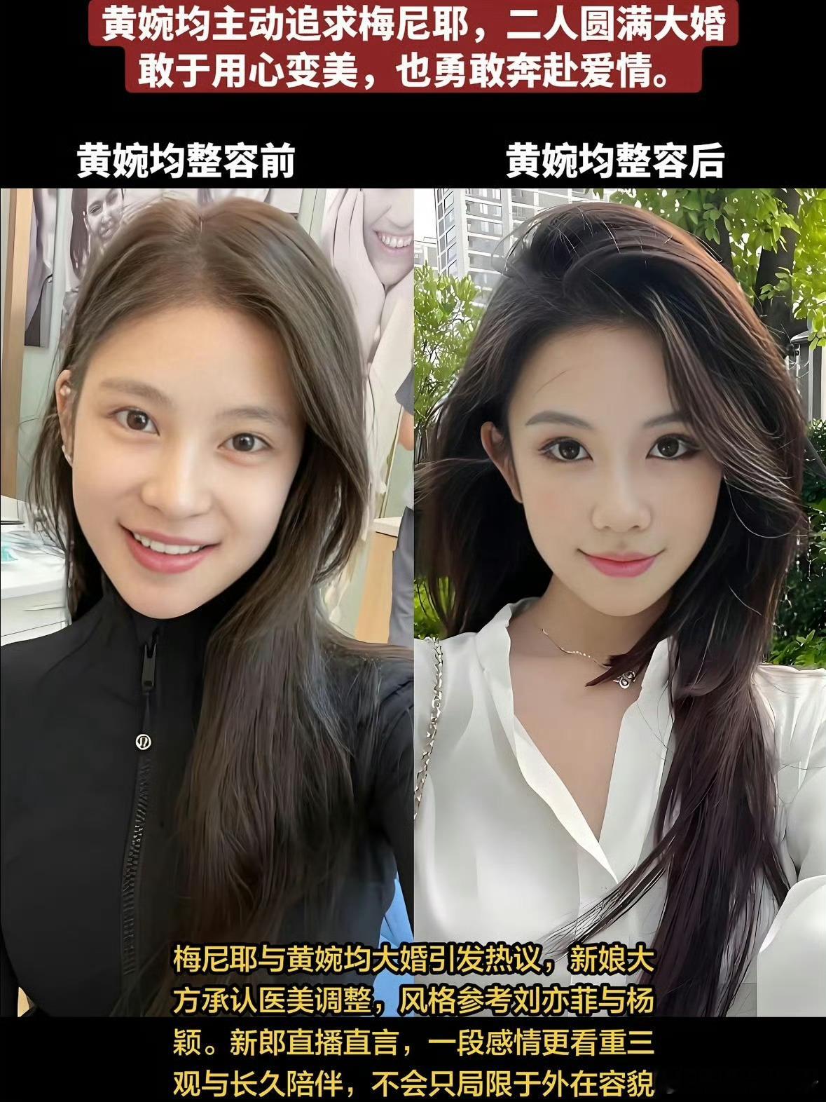 梅尼耶被妻子整容前的照片吓到了黄婉均在直播间自曝整容前旧照梅尼耶演被吓得逃跑，也