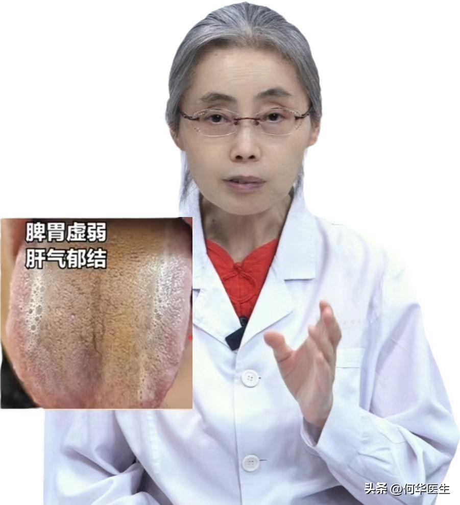 一见苔黄就觉得是湿热，你要真这么治了，只会越来越严重。

这是一位朋友的舌象，自