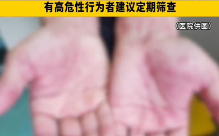 浙江杭州，男子在外面跟一女子亲近了一番，当时并没有采取防护措施，完事后男子就忘记