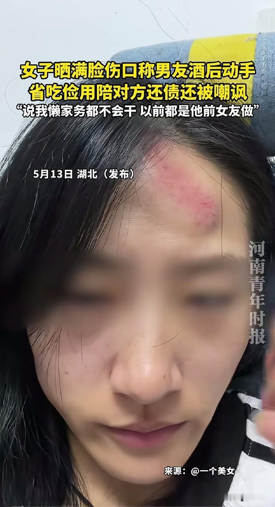 男人总是吃在碗里的看在锅里的，湖北一女子晒出满是伤痕的脸，表示这是男朋友喝醉后打