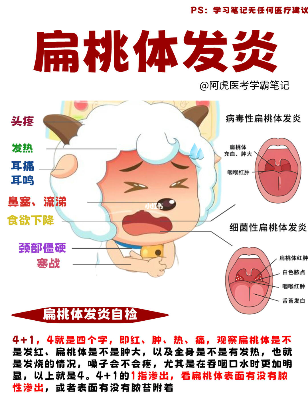 阿虎医考学霸笔记📒：扁桃体发炎怎么测?