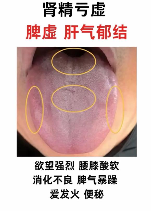 3 种典型舌象，对应 3 类脏腑亏虚问题