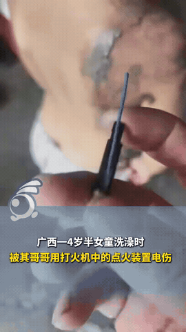 “代价可太大了！”广西，一4岁女孩盆里洗澡玩水时，12岁哥哥突发奇想，玩起了恶作