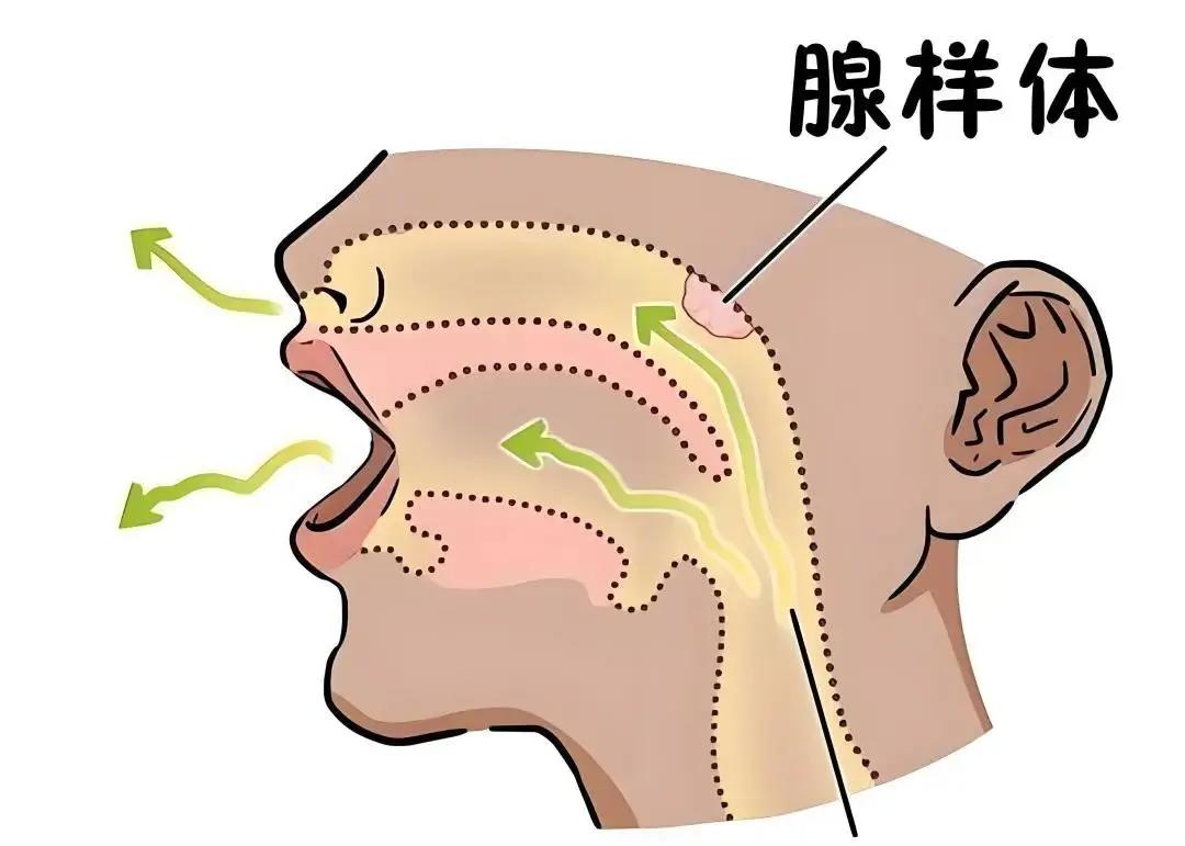 【孩子腺样体肥大，睡前这个习惯，看似正常，实则发病！】
大家好，我是孟牛安。
很