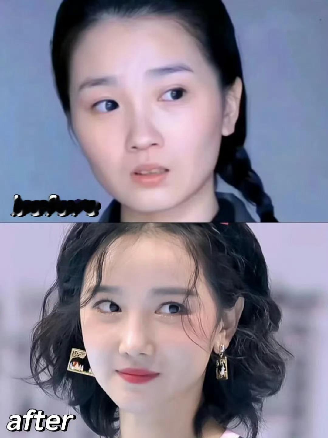陈小纭的脸怎么了？感觉每次消失一段时间，再出现的时候就会换一张脸 ​​​