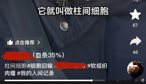 【投】真的只有挂墙上才老实 都得罕见瘤了也不忘猥琐本性 